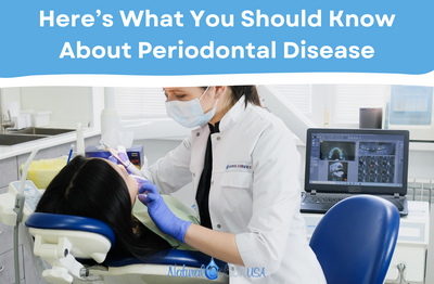 Here’s What You Should Know About Periodontal Disease